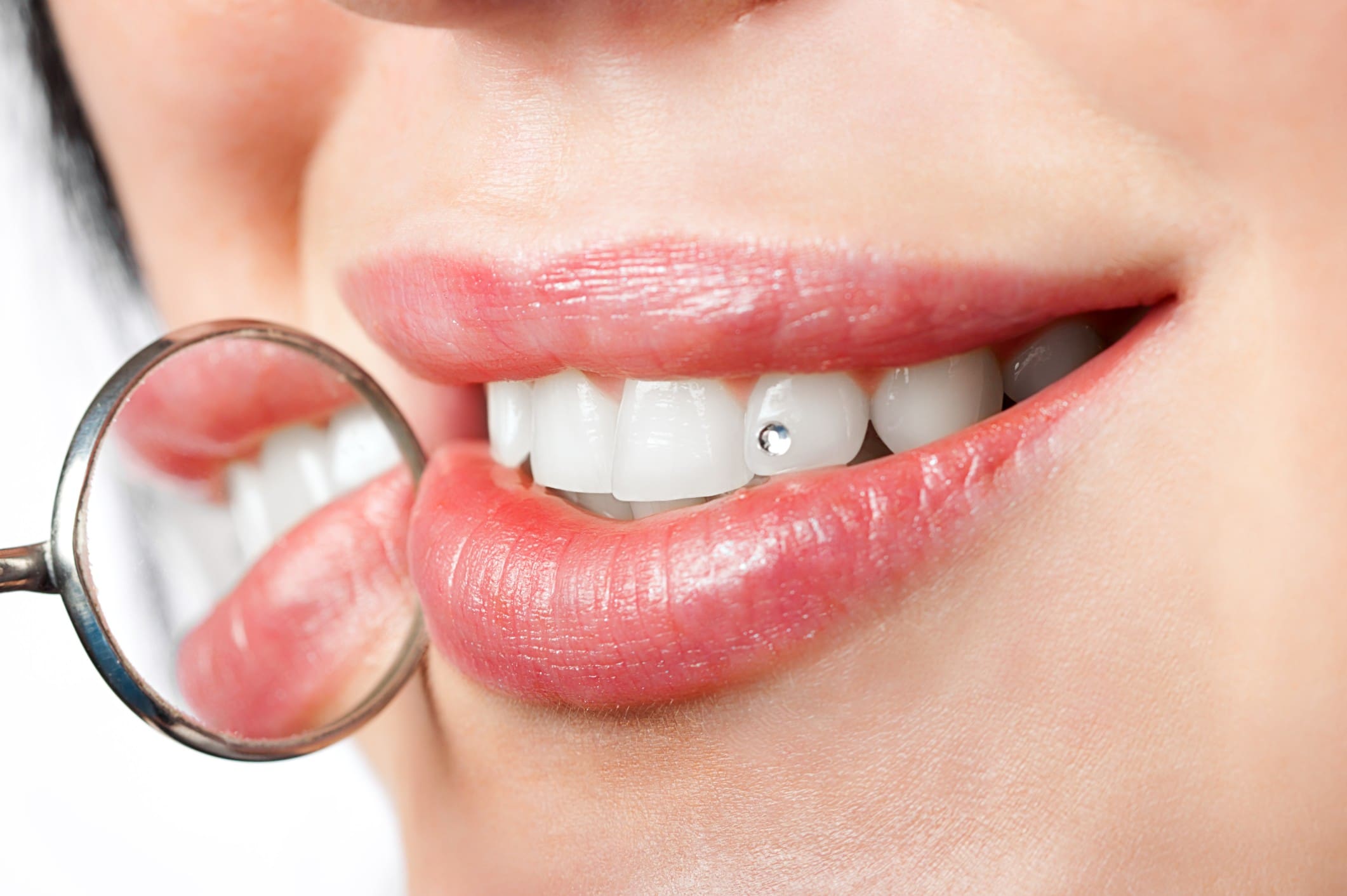 Close-up of teeth with jewel